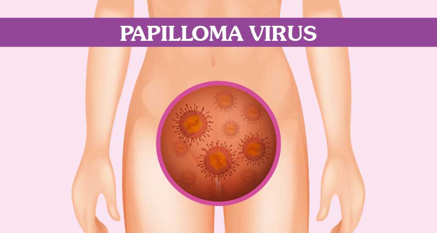Papilloma virus lesione - Papilloma virus collo
